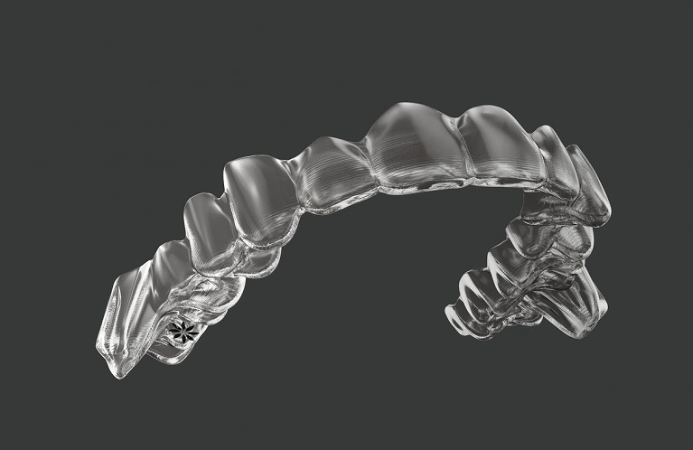 ワイヤーを使わず透明で目立たない「マウスピース矯正」